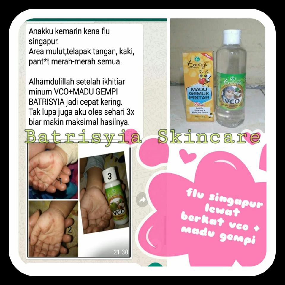 Batrisyia Suplemen Penggemuk Badan Anak / Madu Gempi / Madu Sehat Anak