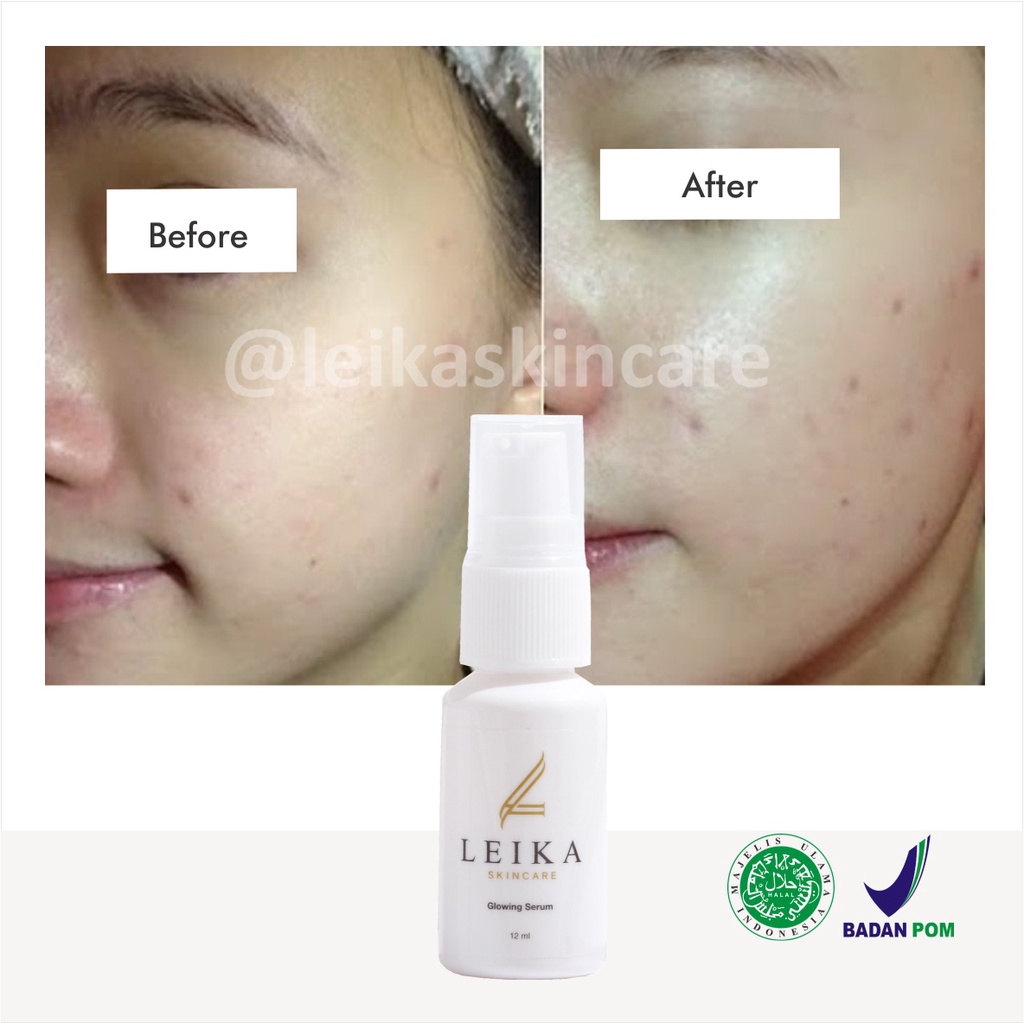 Ampuh! Pelembab Wajah untuk Kulit Wajah Kering dan Kusam Ampun BPOM Pelembab untuk Wajah Buat Kulit Normal Sensitif Glowing Serum Leika Skincare 12ml Asli HALAL MUI Resmi BPOM