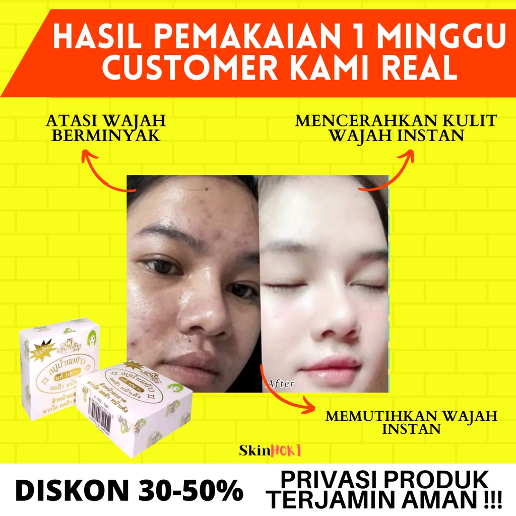 SABUN PENGHILANG JERAWAT PEMUTIH KULIT SABUN KBROTHSIS RICE MILK SOAP PENGHILANG FLEK HITAM ORIGINAL BPOM