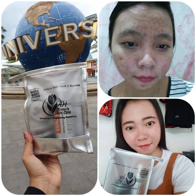 AH MIRECLE SKIN CARE