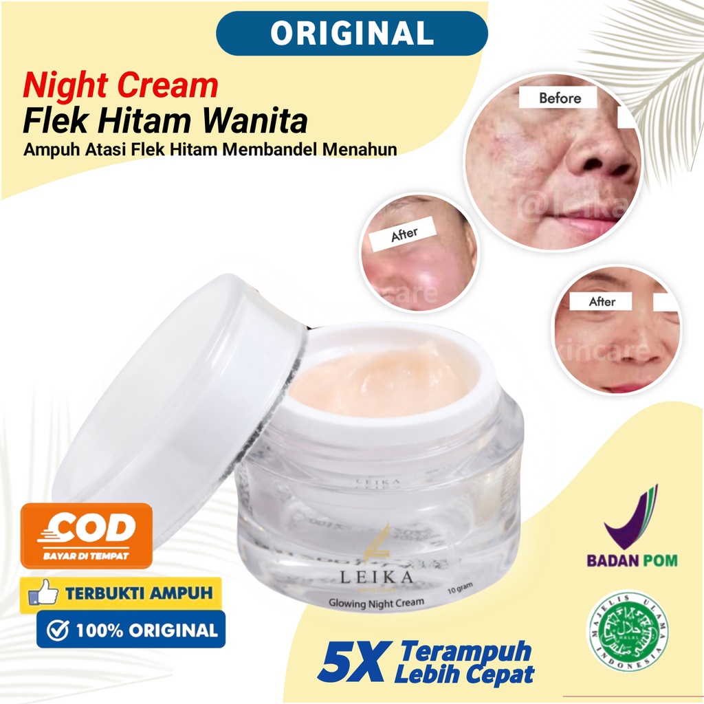 Cream Flek Hitam Membandel BPOM Penghilang Flek Hitam Membandel Menghilangkan Flek Hitam Ampuh Perma