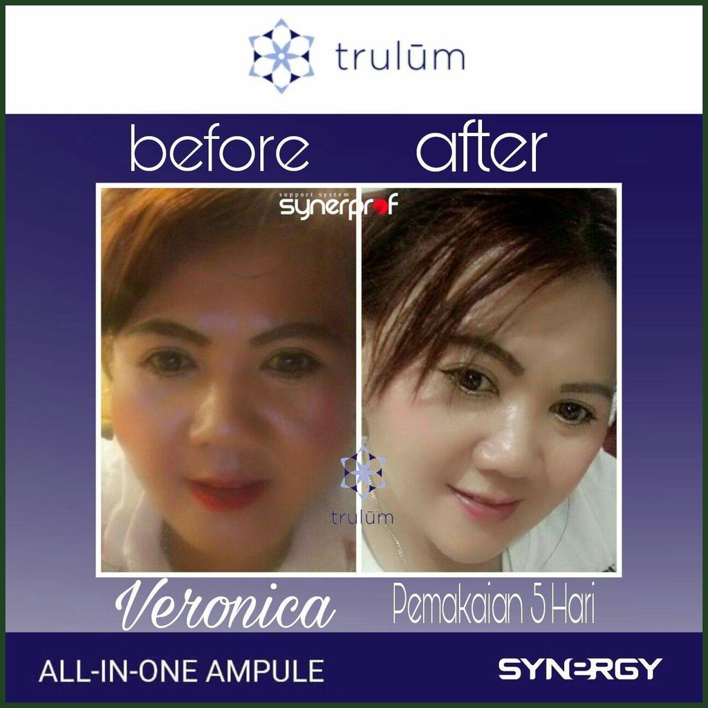 ‰601¿ Skincare Untuk Memperbaiki Tekstur Kulit,..Krim Pemutih Aman Untuk Busui Trulum