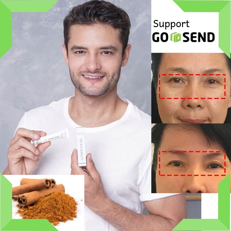 Cod Penghilang Kantung Mata Dan Keriput Ultimate Eye Gel By Nebi Tersertifikasi Badan Pom Eye Cream Shopee Indonesia