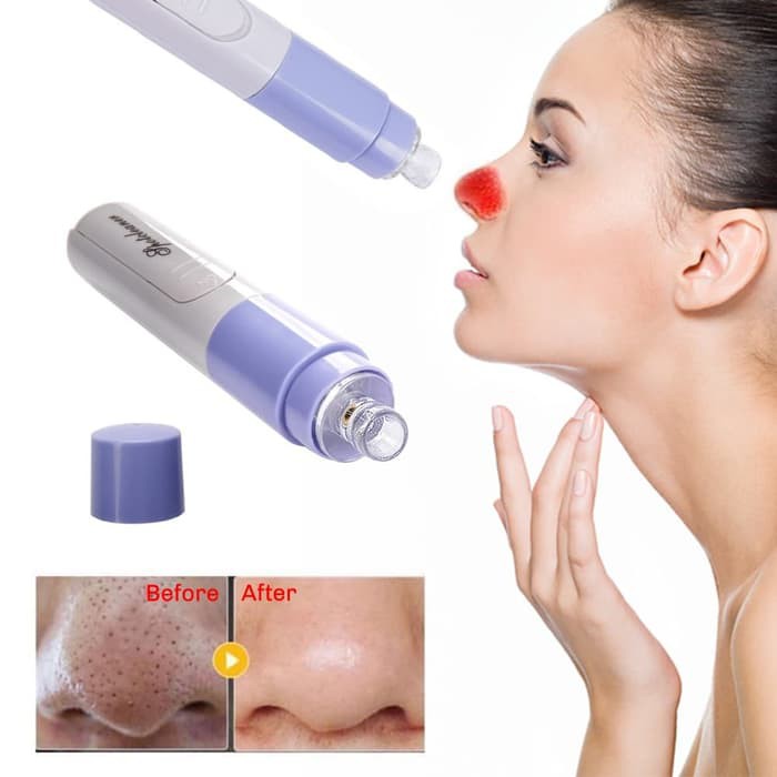 #LC-BeautyTools Alat Penyedot Komedo Cleaner Acne Vacuum Komedo