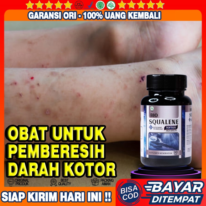 Obat Darah Kotor - Obat Pembersih Darah Kotor - Obat Pengencer Darah - Obat Penghilang Darah Kotor -
