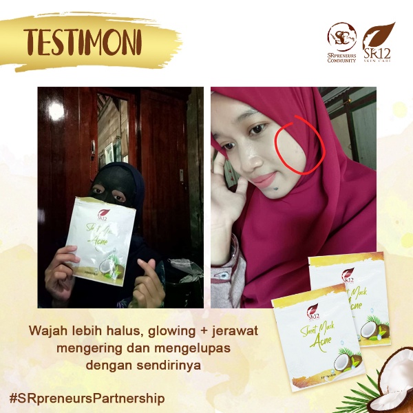 Sheet Mask SR12 | Sheet Mask Acne SR12 &amp; Sheet Mask Brightening SR12 | Masker Wajah SR12 SkinCare