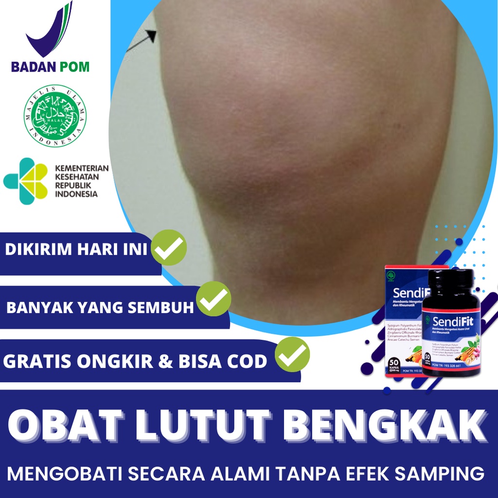 Jual Obat Lutut Bengkak, Obat Lutut Bengkak Dan Memerah, Lutut Kaku ...