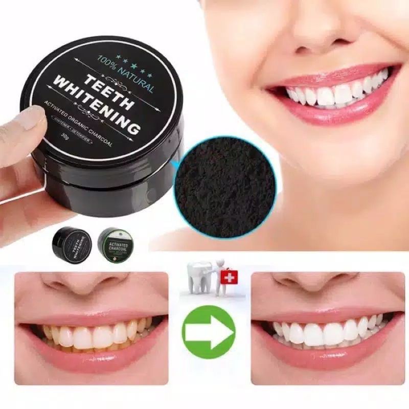 Teeth Whitening