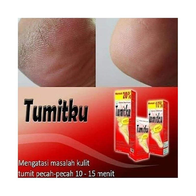 [ORI] OBAT KAKI PECAH AMPUH Mengatasi Kapalan dan Menghaluskan Tumit Kaki Pecah l Tumitku 30ml BPOM