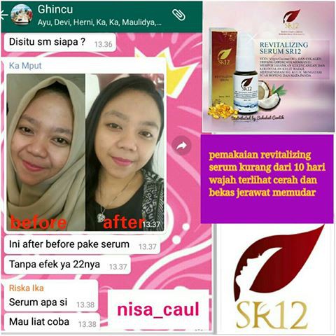 Serum SR12 | Acne Serum SR12 &amp; Revitalizing Serum SR12 | Serum Wajah SR12 Skincare | Pembersih Wajah