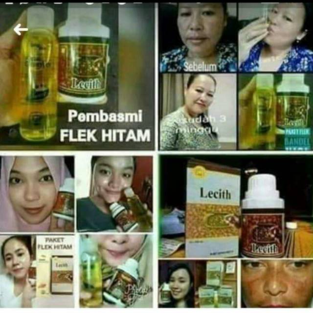 Paket flek hitam Nasa