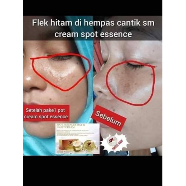 Paket Flek hitam Spot Essence Day dan Night Cream SR12