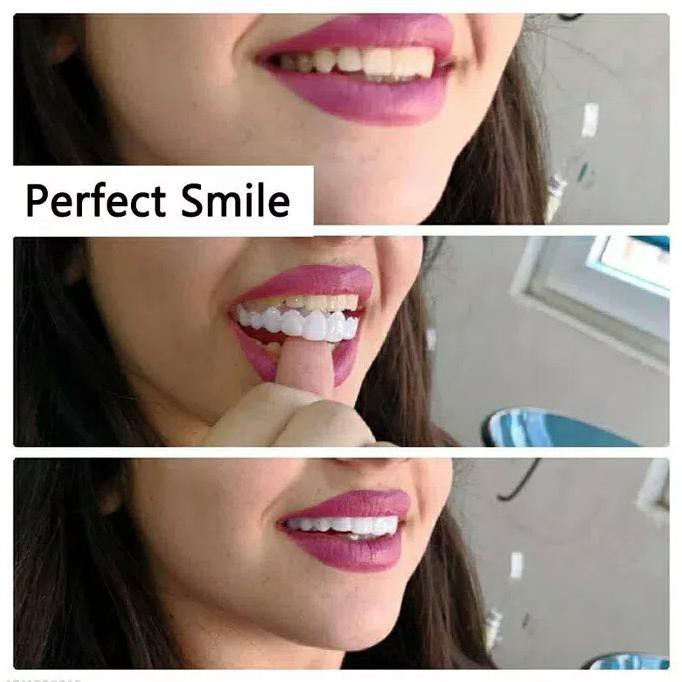 cara senyum untuk gigi tonggos