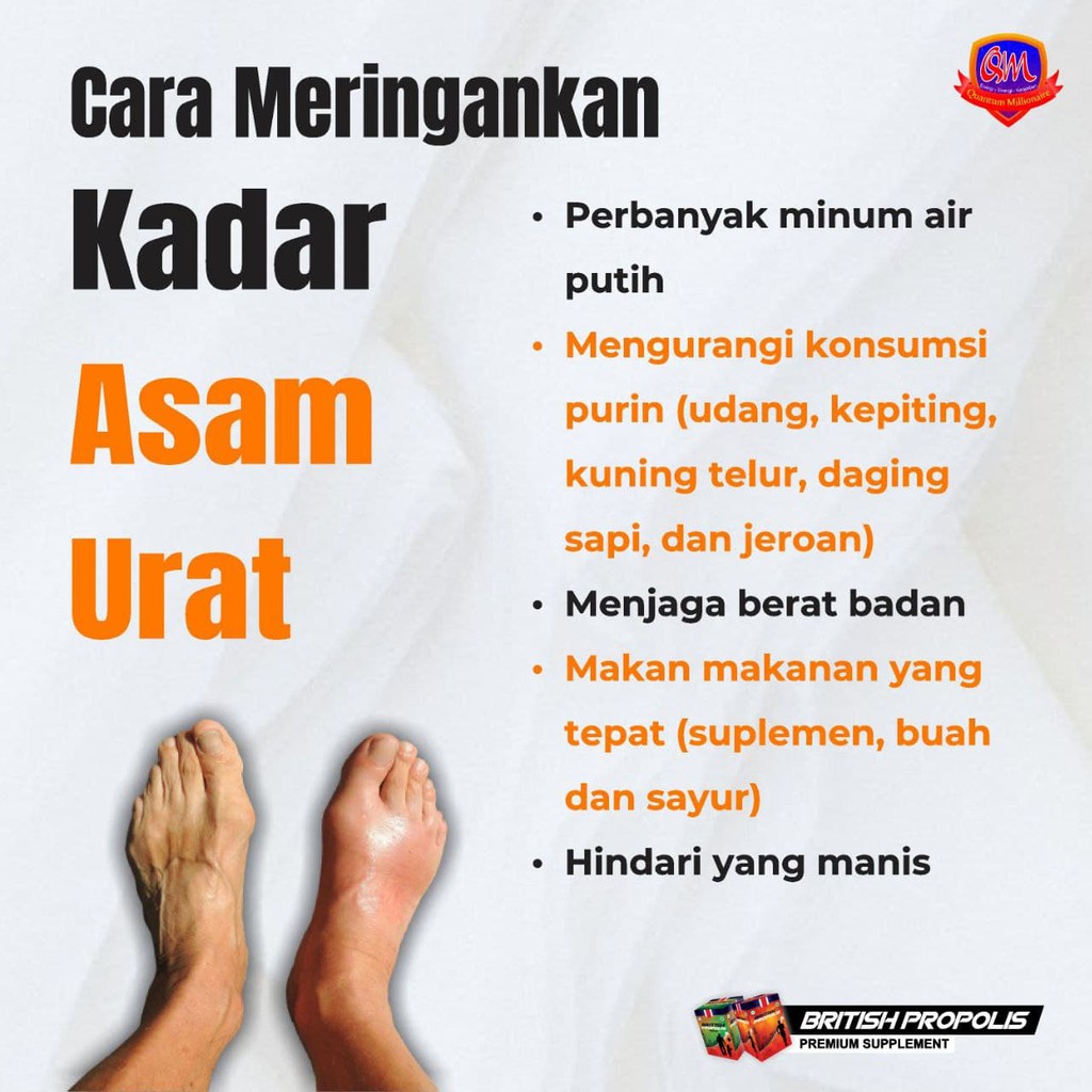 

Obat Asam Urat