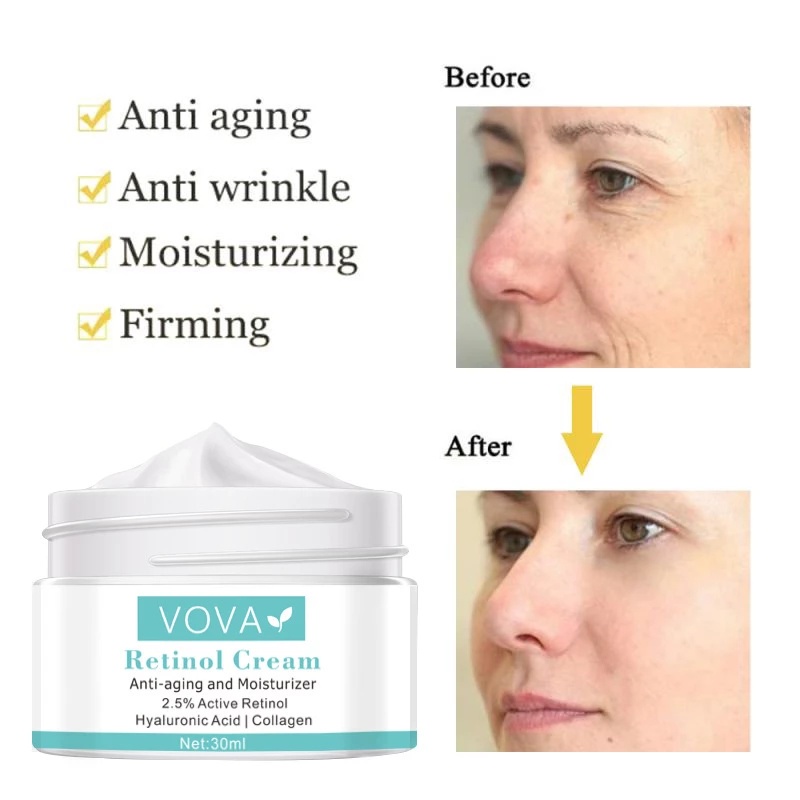 VOVA RETINOL 30g Anti Kerut Krim Mata Menghilangkan Kantong Mata Anti Bengkak Gel Memudar Lingkaran Hitam Anti Aging