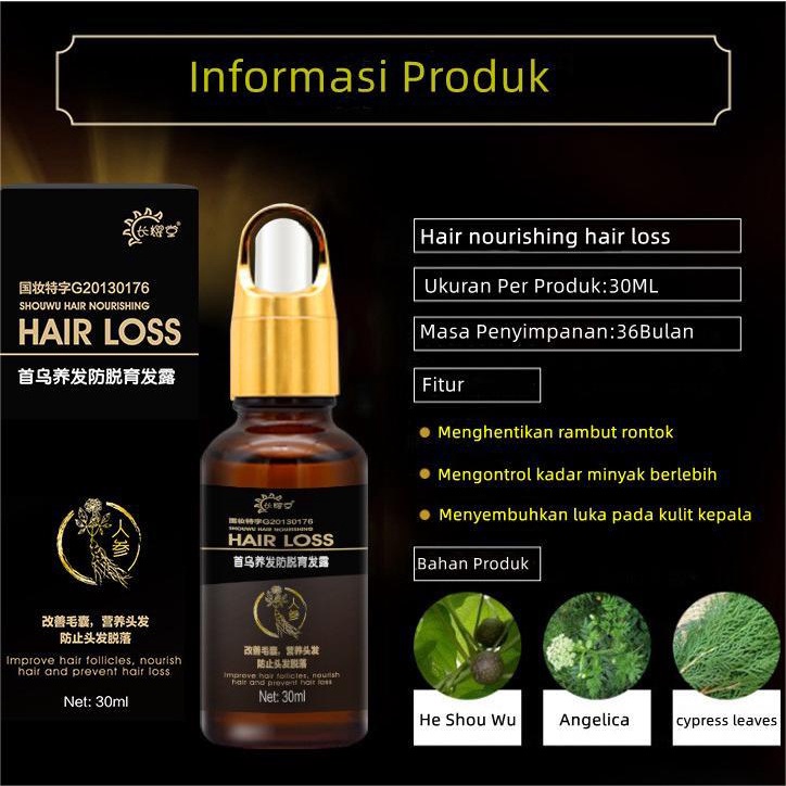 Penumbuh rambut botak Serum rambut rontok 30ml Penumbuh rambut cepat Kontrol minyak Menyuburkan rambut Mencegah Kebotakan-7