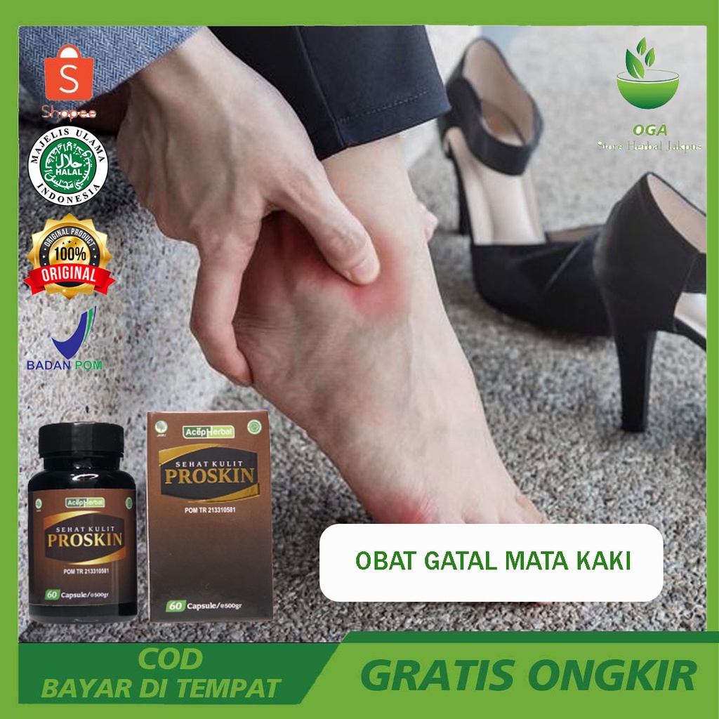 Obat Gatal Mata Kaki Telapak Kaki Jari Kaki Dengan Proskin Obat Kulit Herbal