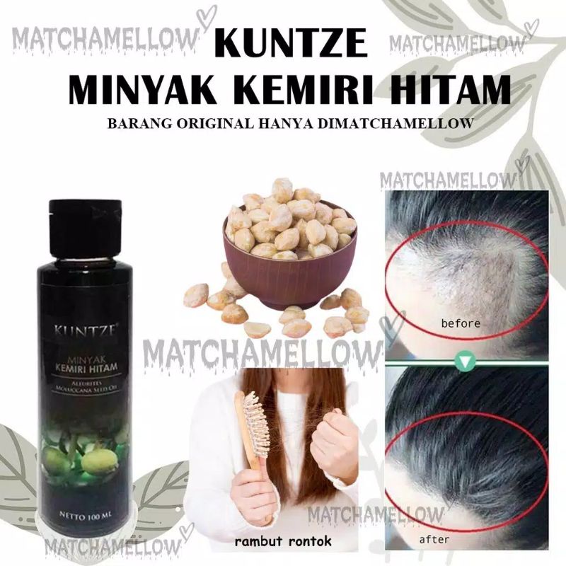 Penumbuh Rambut Botak Alami Nutrisi Rambut Ori BPOM - Penyubur