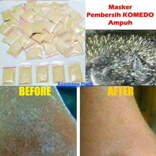 MASKER KOMEDO GELATIN ASLI TULANG SAPI 100% ORIGINAL