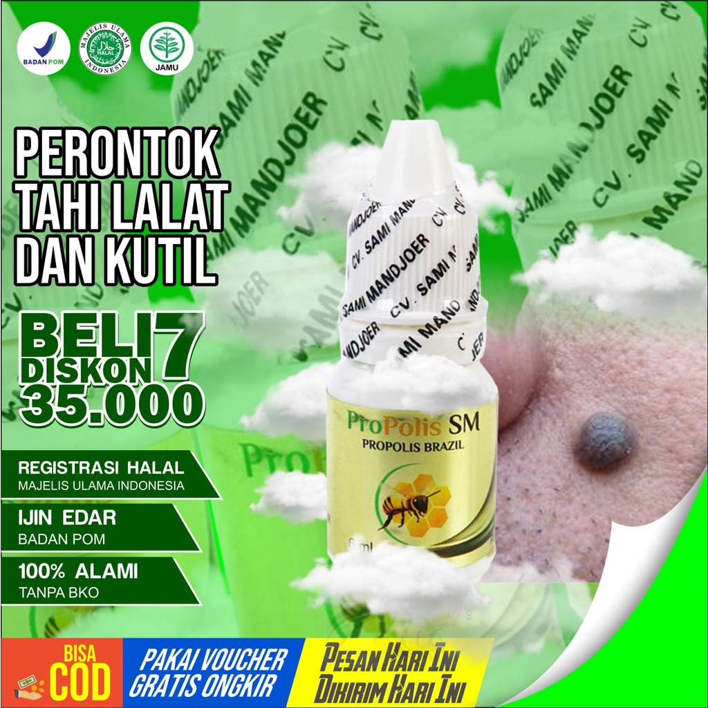 Obat Tahi lalat Obat Kutil - OBAT PERONTOK TAHI LALAT DAN KUTIL PAPILOMA PROPOLIS SM