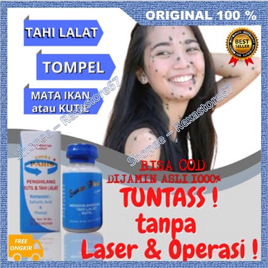 [BISA COD]  BELI 2 GRATIS 1 Salep Kutilang Salep Tahi Lalat, Kutil & Daging Tumbuh Ampuh ASLI