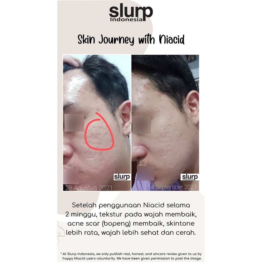 Niacid by Slurp Laboratories Korea All in One Face Serum BPOM Approved Bergaransi Asli-4