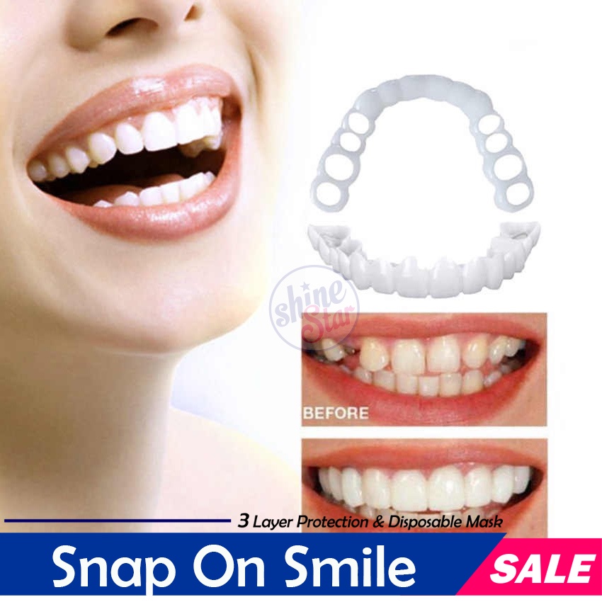 [ BAYAR TEMPAT ] Original 100% Snap On SMILE Sepasang Gigi Palsu Atas Bawah Cabut Pasang