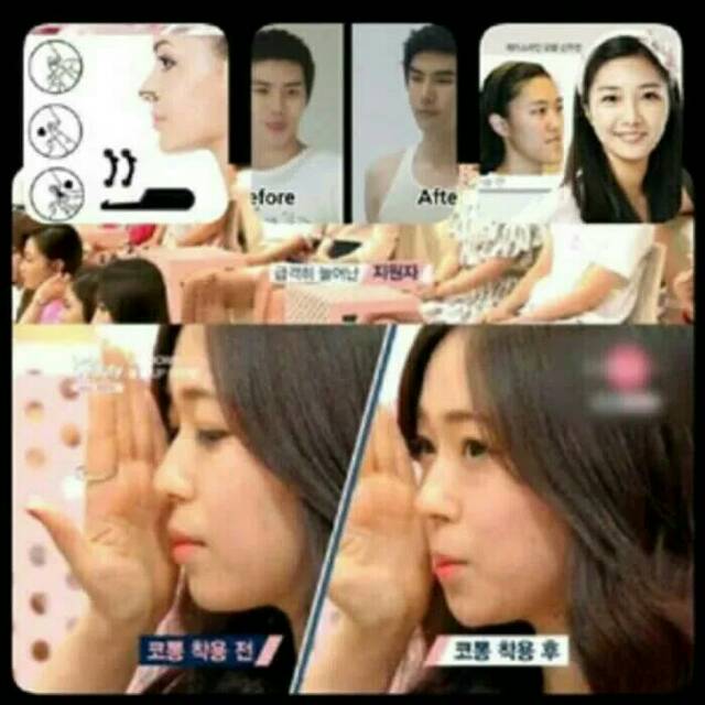 PEMANCUNG HIDUNG INSTANT SUPER NOSE SECRET HIGH STEALTH 3D