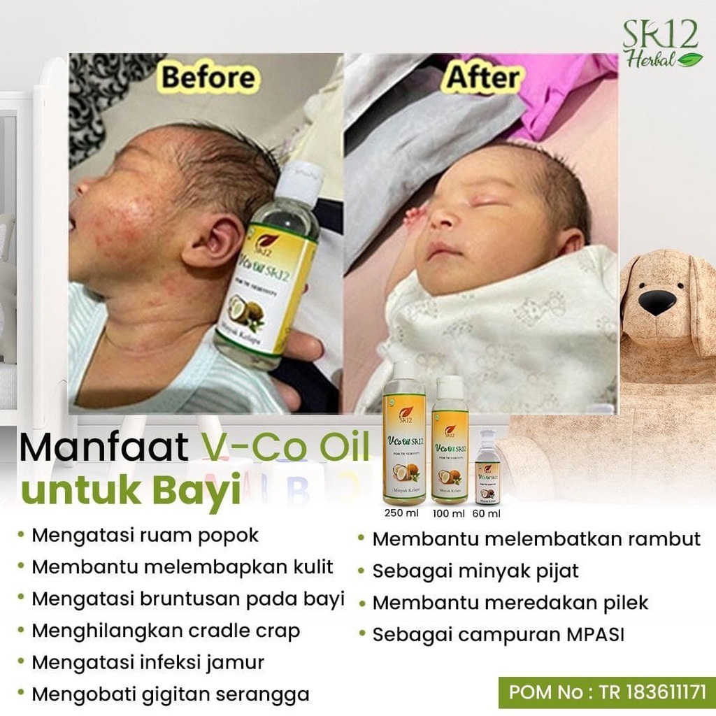 Vco Minyak Kelapa - Vco Virgin Coconut Oil - Vco SR12