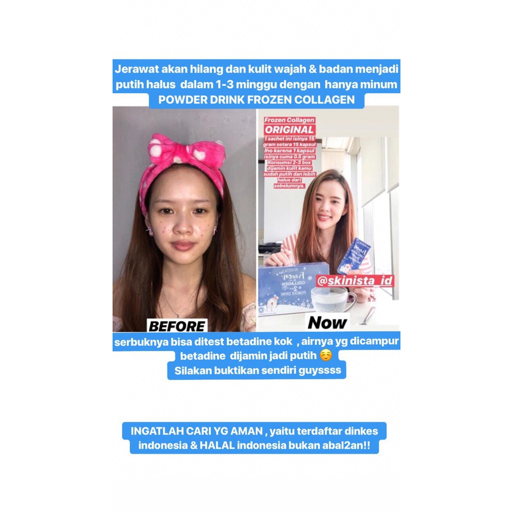[ COLLAGEN ] FROZEN COLLAGEN 2 IN 1 WHITENING X 10 THAILAND