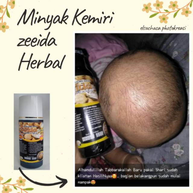 Harga zeida Terbaru Jul 2026 | BigGo Indonesia