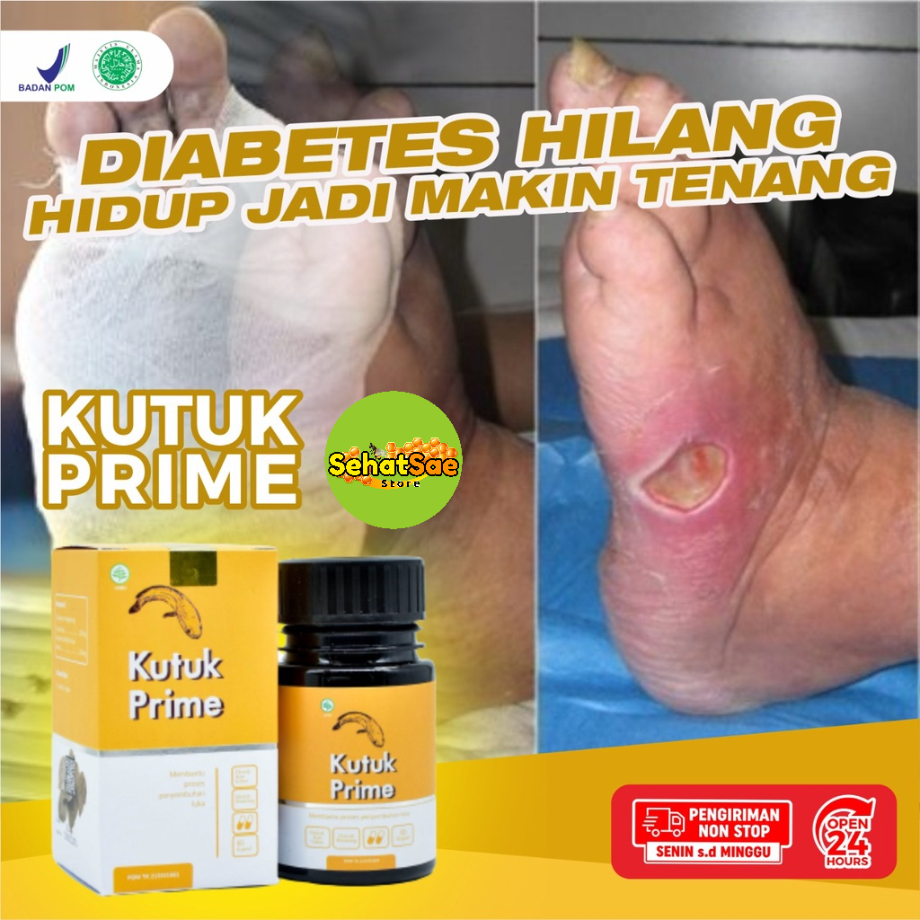 Kapsul Kutuk Prime Original – 100% Ekstrak Ikan Gabus Atasi Luka Operasi Sembuhkan Diabetes Cepat Keringkan Luka Operasi Turunkan Kadar Gula Diabetes Cegah Infeksi Pada Luka Cegah Keloid Atasi Luka Bakar Kecelakaan