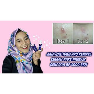 VIVA ACNE LOTION / VIVA LOTION OBAT JERAWAT - 30ML