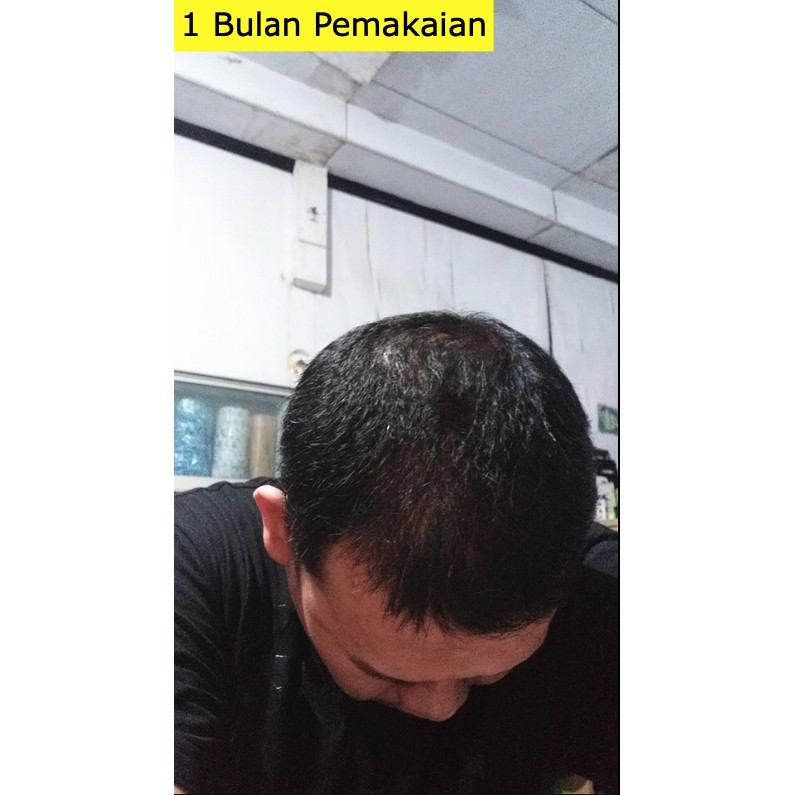 KELAYA HAIR TREATMENT SHAMPOO SOLUSI RAMBUT RONTOK & KEBOTAKAN 250ML-8