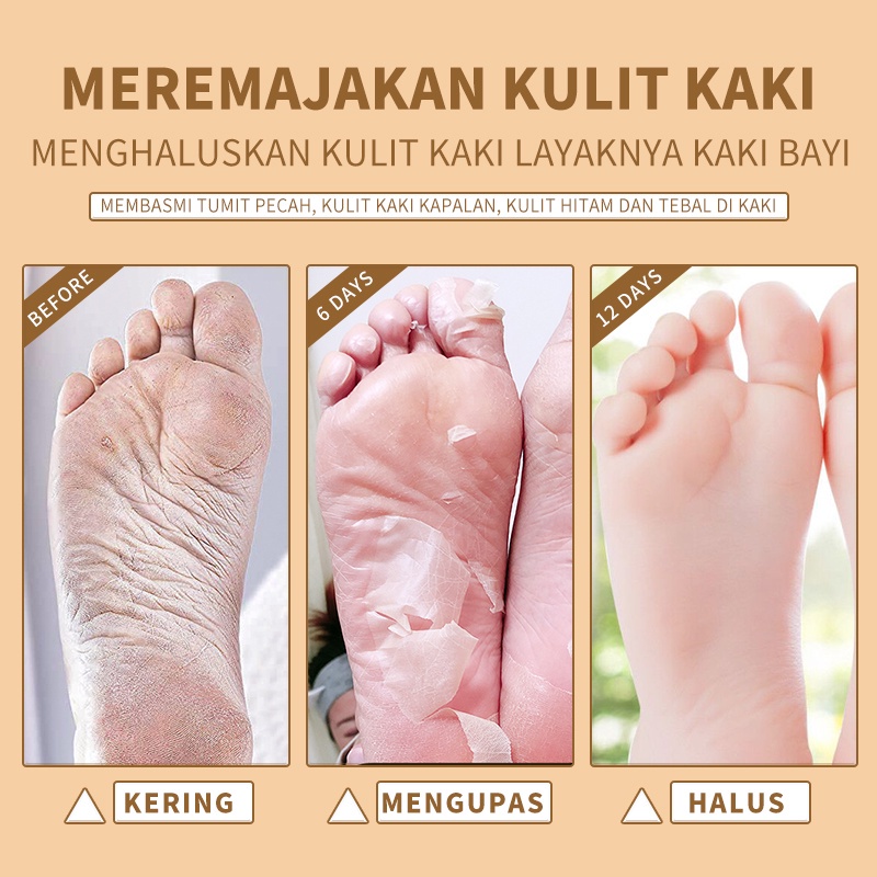 (READY&amp;ORI) Kimuse Foot Mask Soft Touch Exfoliating KMS910 911 912 masker kaki ekfoliasi eksfoliating