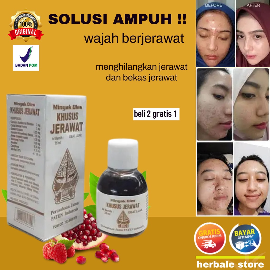 PENGHILANG BEKAS JERAWAT AMPUH PRIA MENGHILANGKAN BEKAS JERAWAT OBAT JERAWAT DAN BEKAS JERAWAT OBAT 