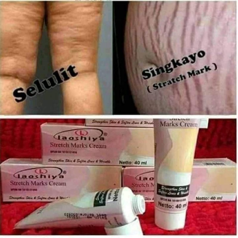 Laoshiya stretchmark