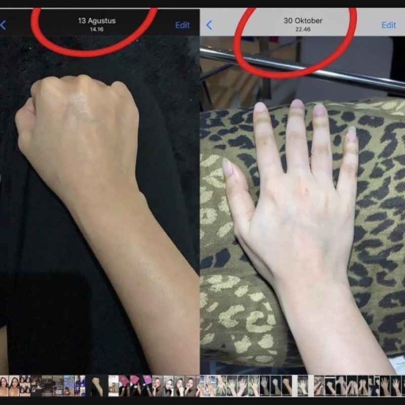 Replacement Infus Cromosom