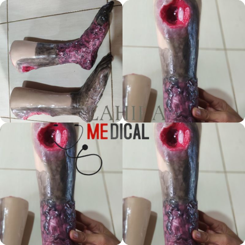 PHANTOM / MANIKIN / MANEKIN KAKI LUKA DECUBITUS