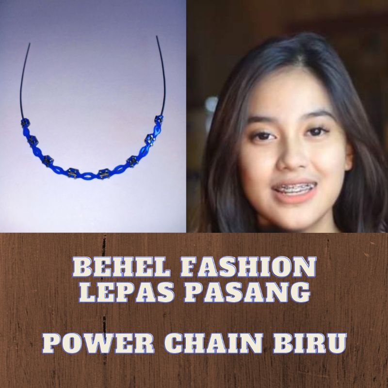 Behel gigi Lepas Pasang Behel Fashion Anti Karat Original Model Power Chain  Warna Biru