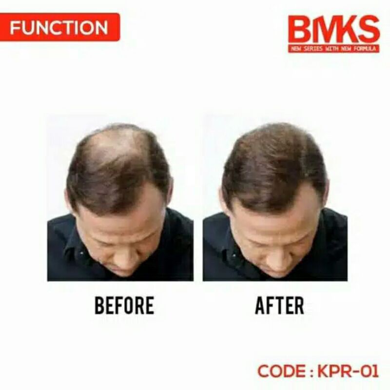 ⭐️ Jendela Kosmetik ⭐️ ( BPOM ) BMKS Conditioner / BMKS Perawatan Kulit Kepala / Conditioner BMKS / Perawatan Rambut / Conditioner Rambut / Kondisioner Rambut / Kondisioner