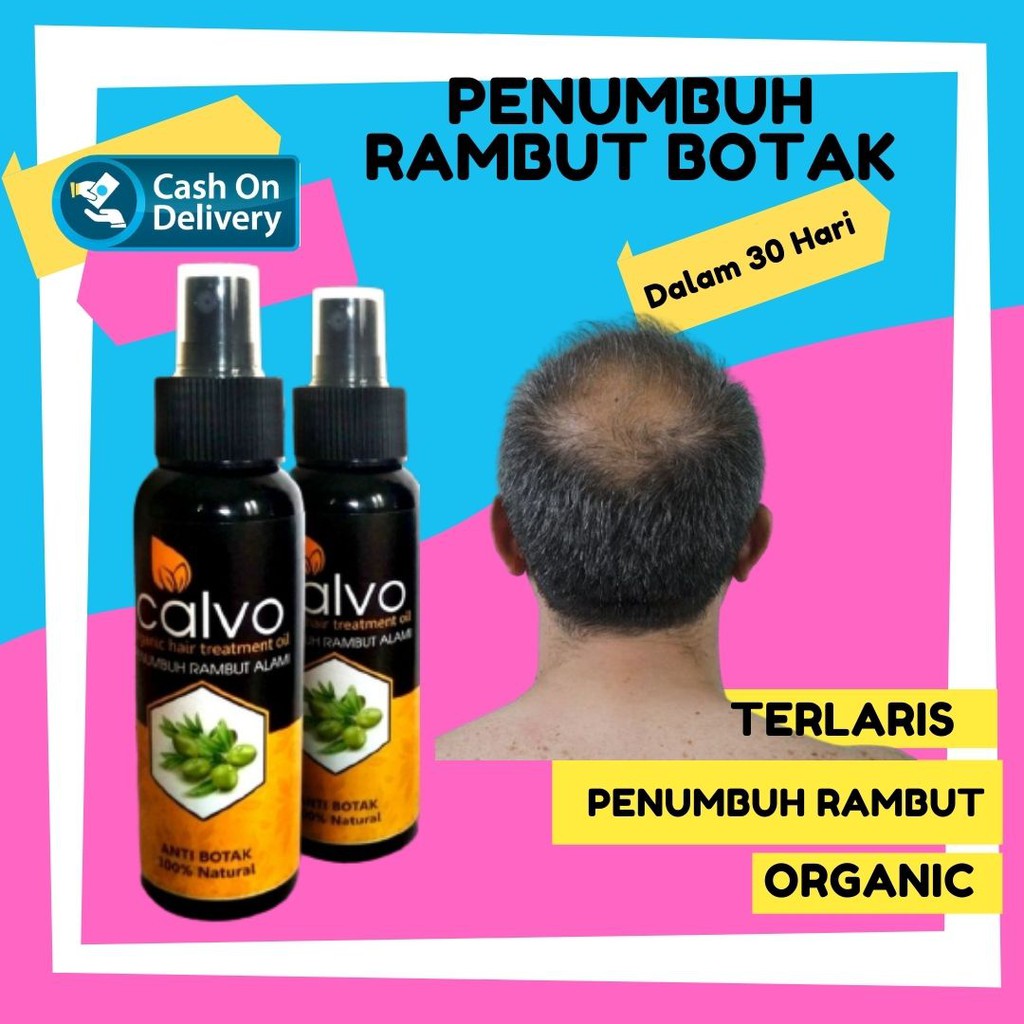 serum penumbuh rambut botak super cepat, penumbuh rambut botak dan rontok untuk wanita, penumbuh ram
