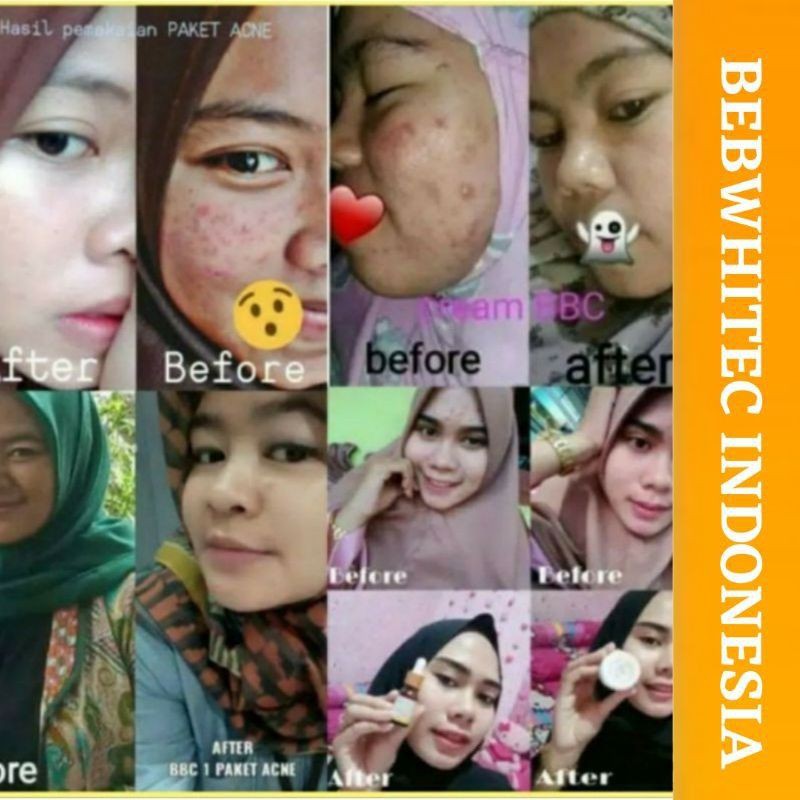 BEBWHITE C SKINCARE PAKET GLOW PAKET ACNE ORIGINAL BBC BPOM-4