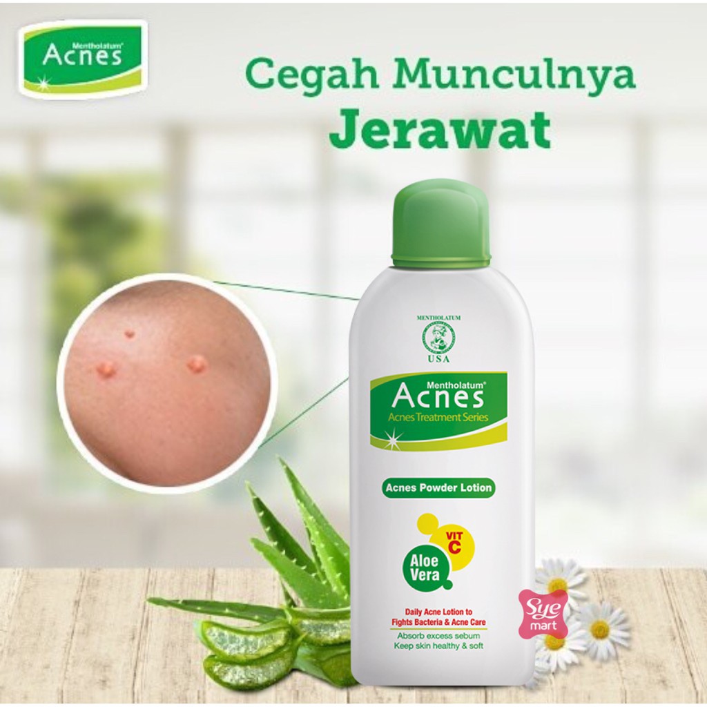 BPOM ACNES OIL CONTROL TONER 100ML , ACNES POWDER LOTION 100ML , ACNES MILK CLEANSER 110ML / SYE