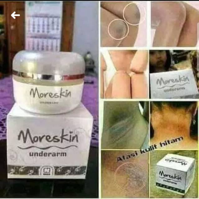 Moreskin underarm