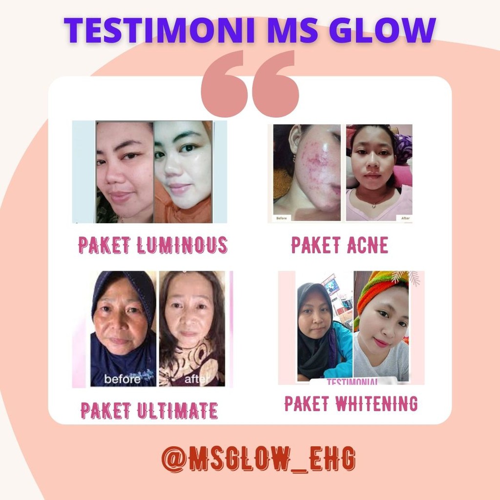 PERAWATAN WAJAH MS GLOW WHITENING MS GLOW ORI SERUM MS GLOW