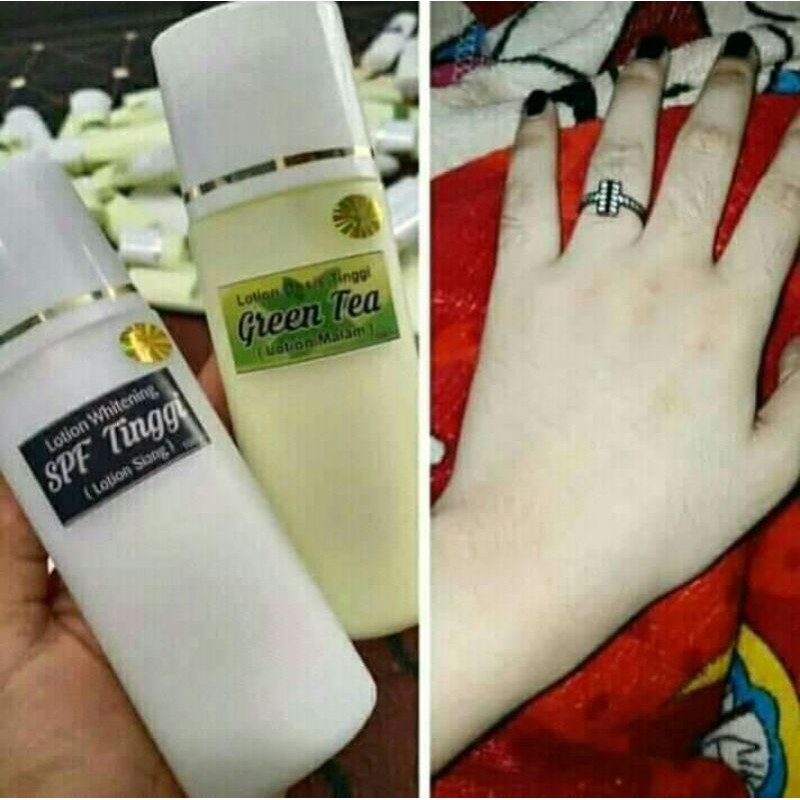 

HANDBODYDOSTING