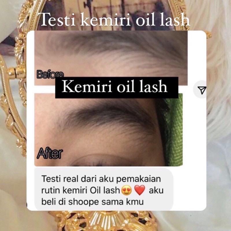 [READY] KEMIRI OIL BY SKINCAREBY_SM  (SERUM PELEBAT ALIS BULU MATA) 100% MINYAK KEMIRI ASLI