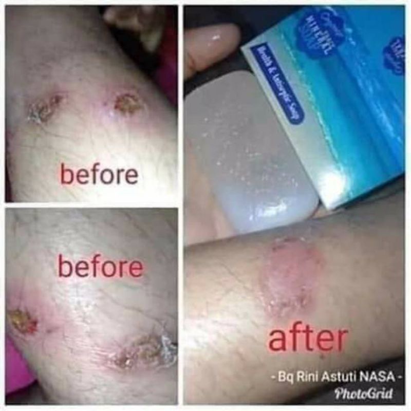 COD FREEONGKIR SABUN TRACE MINERAL OROGINAL NASA SABUN OBAT GATAL ANTI SEPTIK