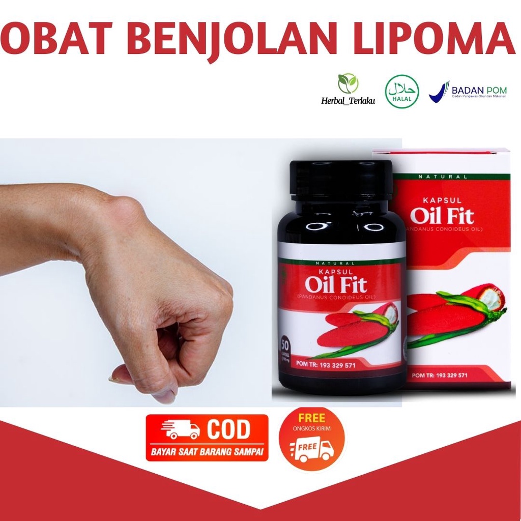 Jual Obat Pengempis Benjolan Lipoma - Penghilang Benjolan - Penghancur ...